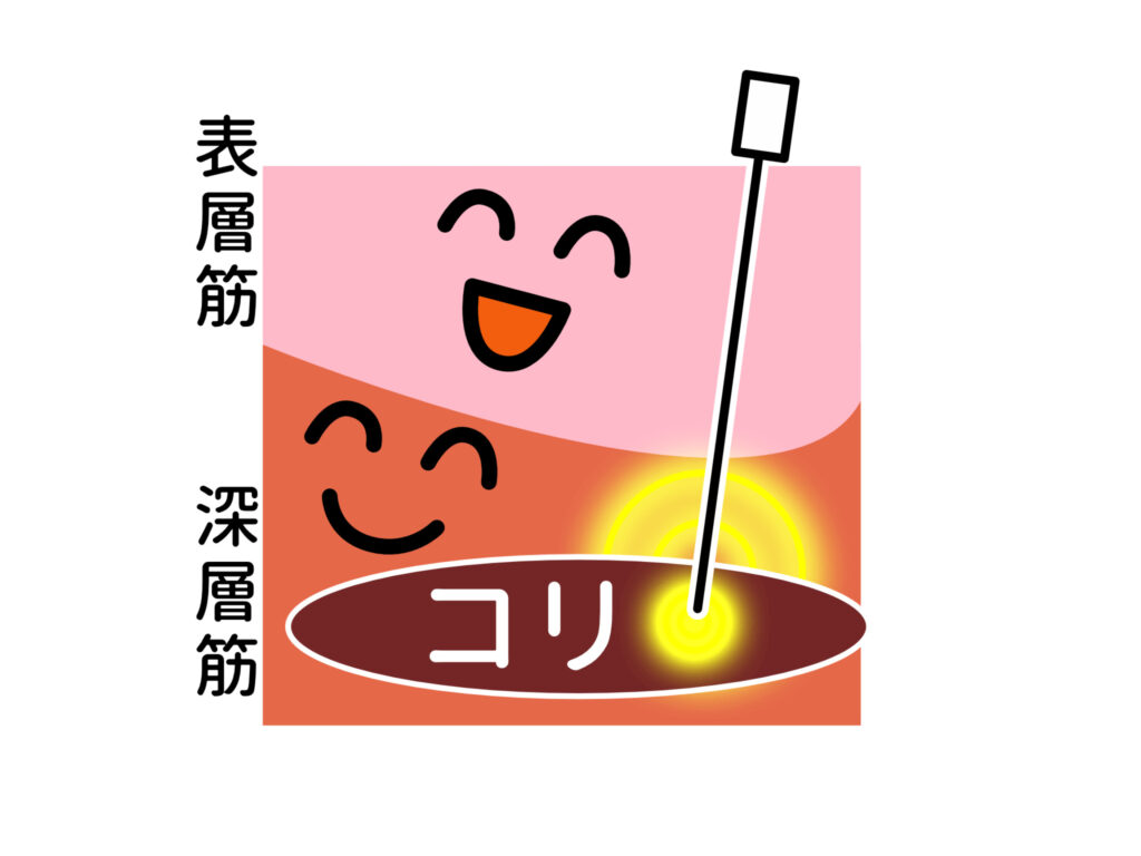 筋肉への直接アプローチ