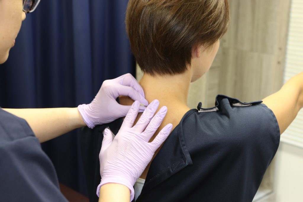 遠隔アプローチ